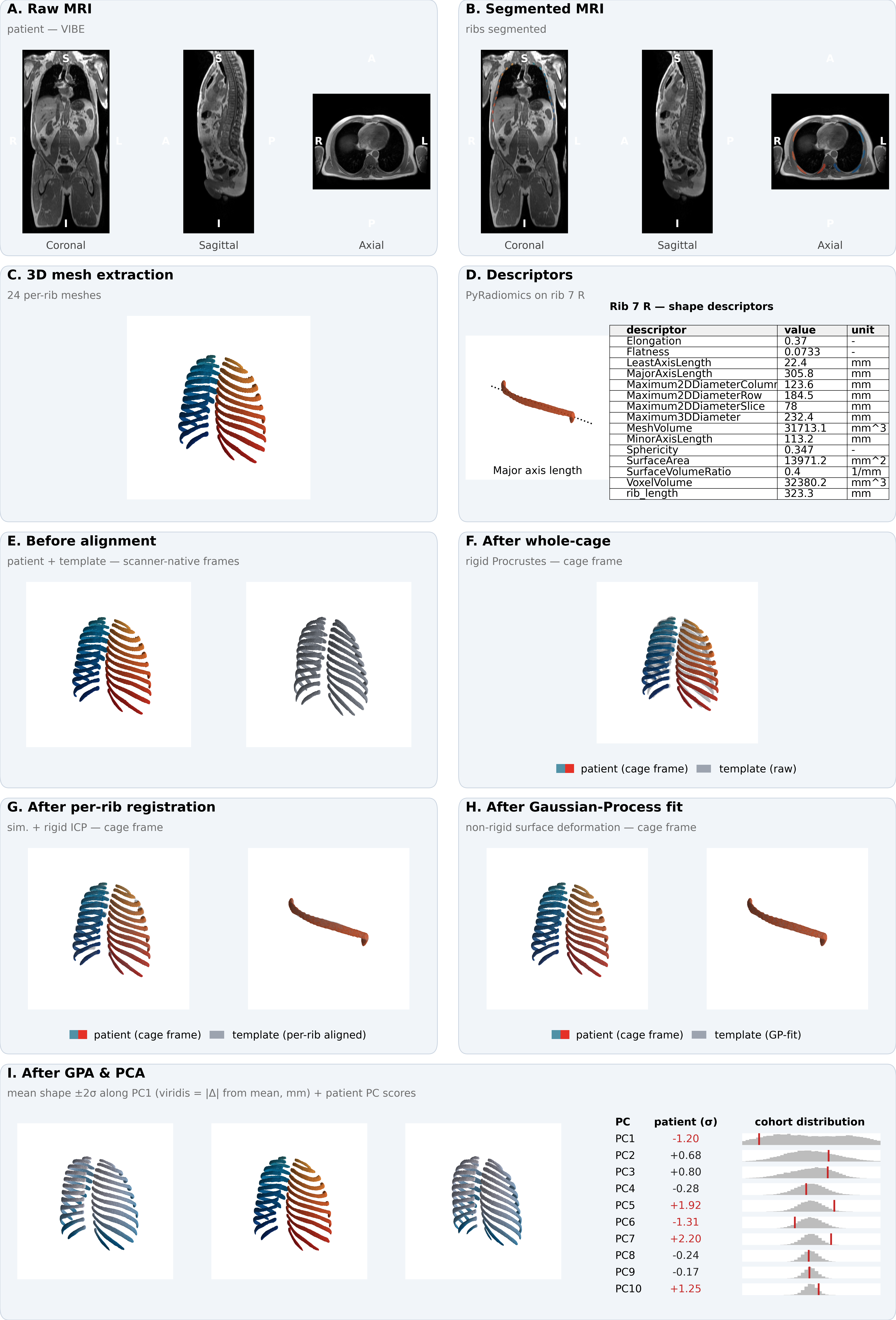 Ten-panel pipeline overview from raw MRI through segmentation, mesh extraction, descriptors, mesh-to-template registration, GPA, and PCA.